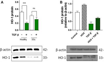 Downregulation of Vascular Hemeoxygenase-1 Leads to Vasculopathy in Systemic Sclerosis